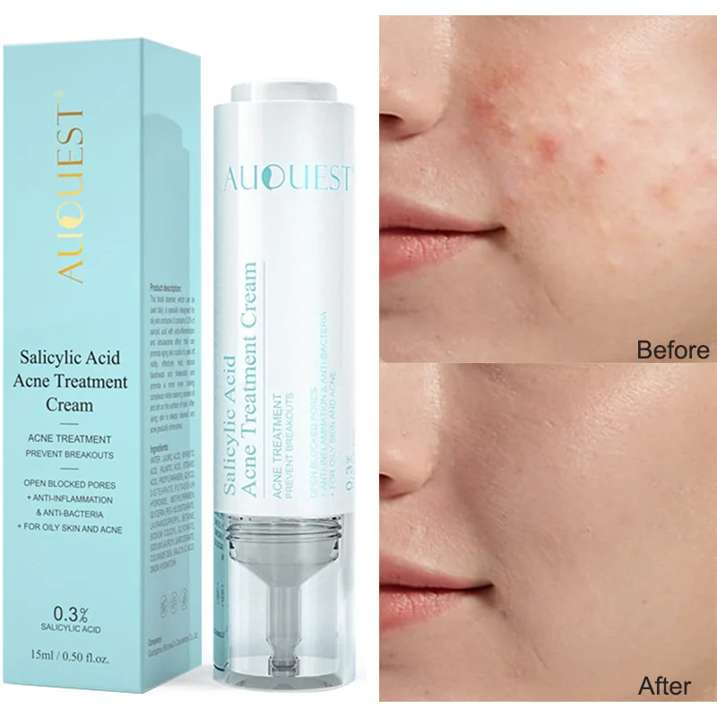 Salicylic Acid Repair Lotion Oil Control Moisturizing Nourish Soothing Repair Essence Remove Acne Shrinks Pores Face Care Cream
Salicylic Acid Repair Lotion Oil Control Moisturizing Nourish Soothing Repair Essence Remove Acne Shrinks Pores Face Care Cream
