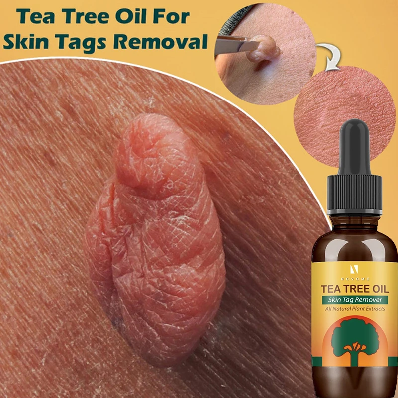Fast Painless Wart Flat Wart Skin Repair Traceless Beauty Serum Skin Treatment Wart Removal Wart Mole Essence
Fast Painless Wart Flat Wart Skin Repair Traceless Beauty Serum Skin Treatment Wart Removal Wart Mole Essence