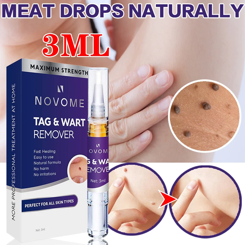 7DAYS Skin Tag Remover Wart Removing Water Fast-Acting Remove Skin Tags Anti-Scarring Skin Tag Remover
7DAYS Skin Tag Remover Wart Removing Water Fast-Acting Remove Skin Tags Anti-Scarring Skin Tag Remover