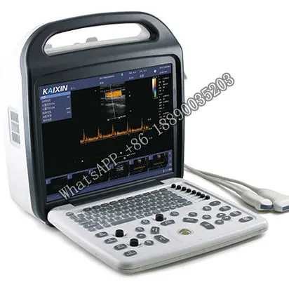 High Performance Ultrasound Machine Color Doppler Ultrasound Scanner
High Performance Ultrasound Machine Color Doppler Ultrasound Scanner