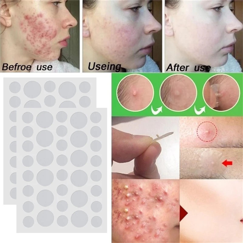 36pcs Waterproof Acne Pimple Patch Hydrocolloid Stickers Acne Treatment Pimple Remover Tool Blemish Spot Facial Mask Skin Care
36pcs Waterproof Acne Pimple Patch Hydrocolloid Stickers Acne Treatment Pimple Remover Tool Blemish Spot Facial Mask Skin Care