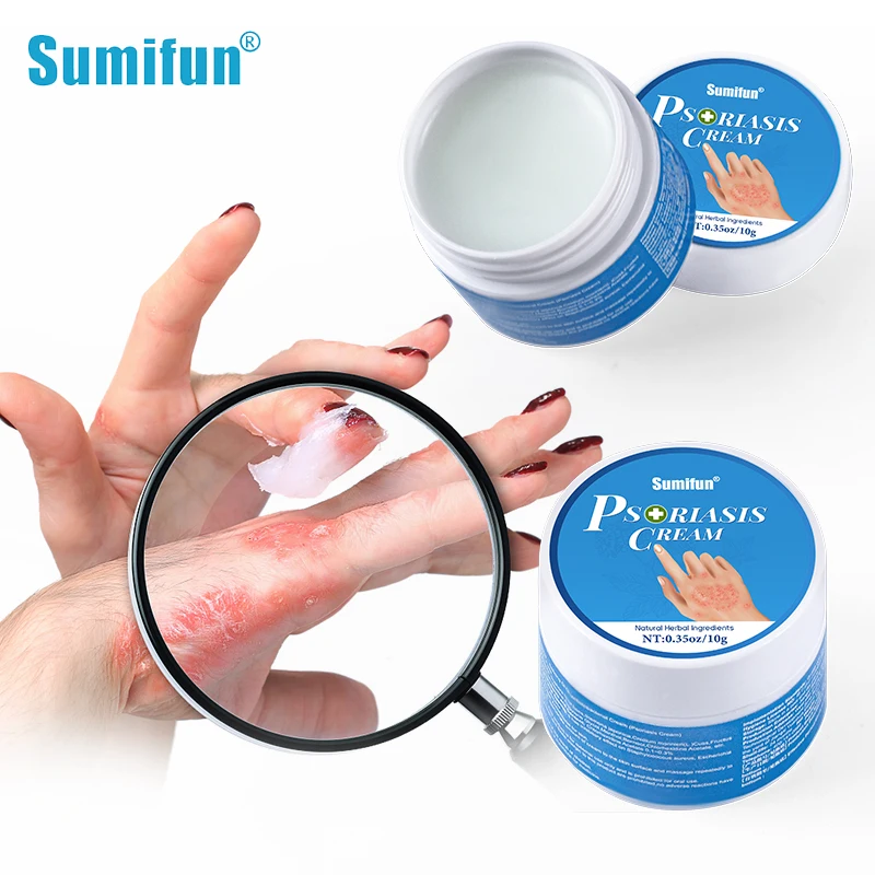 

Sumifun Psoriasis Cream Scalp Dermatitis Medicine Medical Eczema Rapid Treatment Herbal Ointment Medical Itching Skin Care 2023