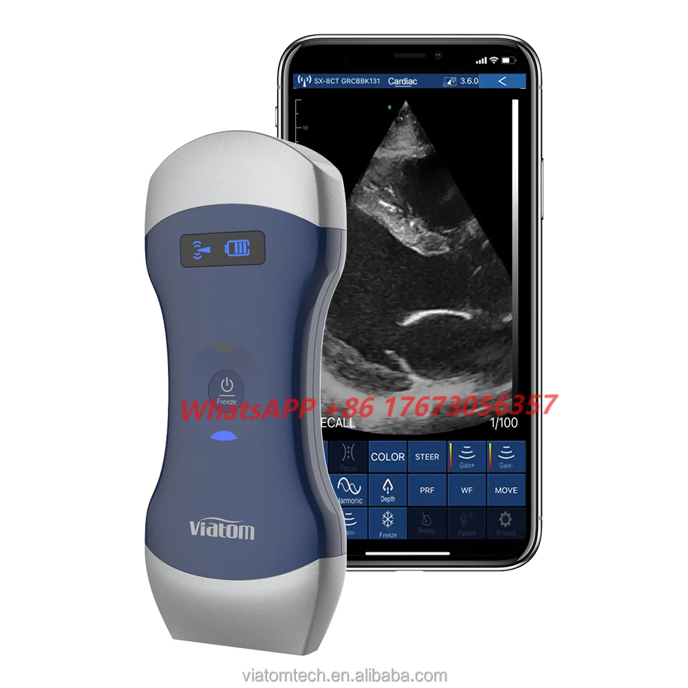 

Viatom 128 Elements Mobile Phone Ultrasound Scanner Color Doppler Handheld Wireless Ultrasound Linear Probe Portable Ultrasound