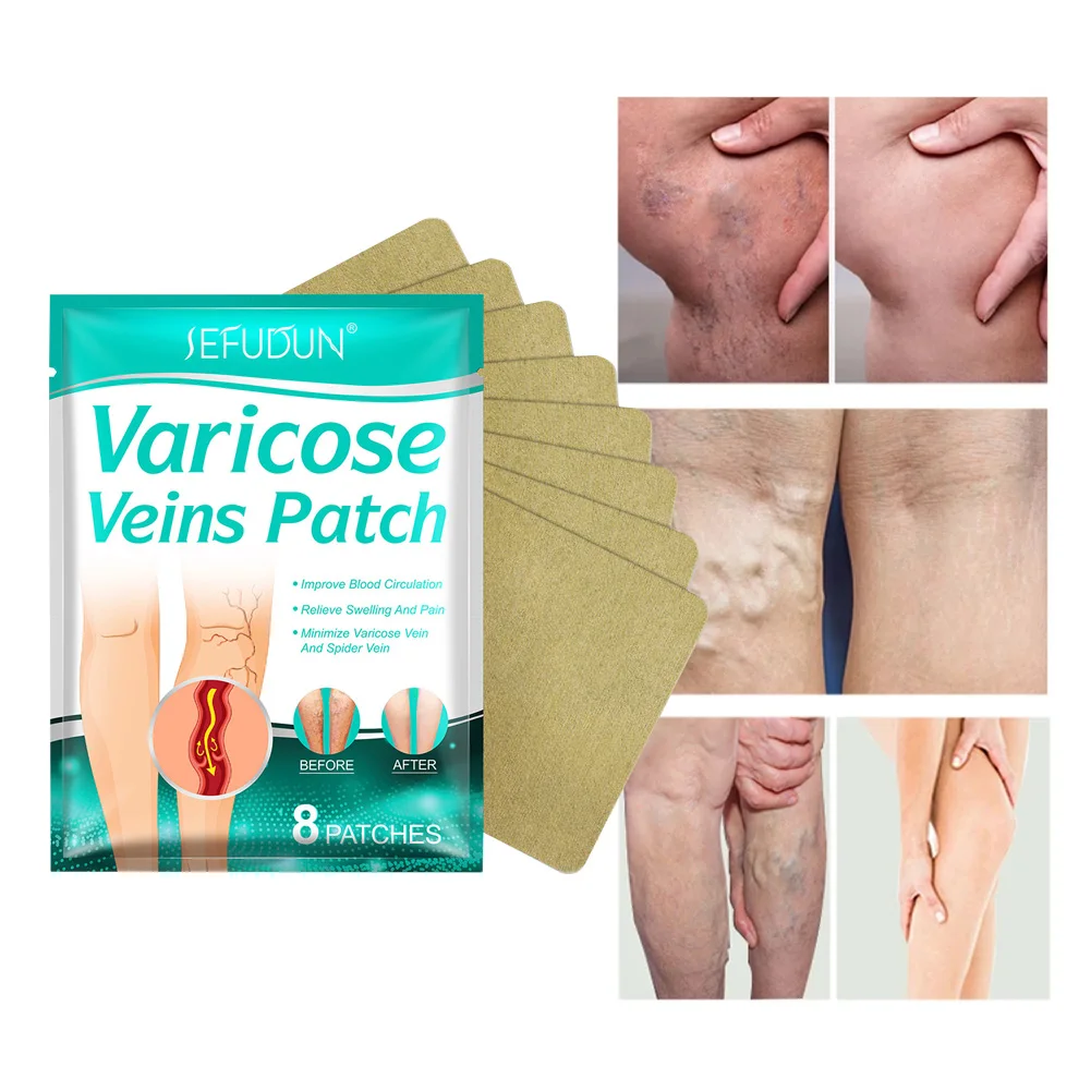8 Patches Varicose Veins Patch Leg Pain Swelling Relief Plaster Spider Varicosity Angiitis Removal Phlebitis Treatment Patch
8 Patches Varicose Veins Patch Leg Pain Swelling Relief Plaster Spider Varicosity Angiitis Removal Phlebitis Treatment Patch