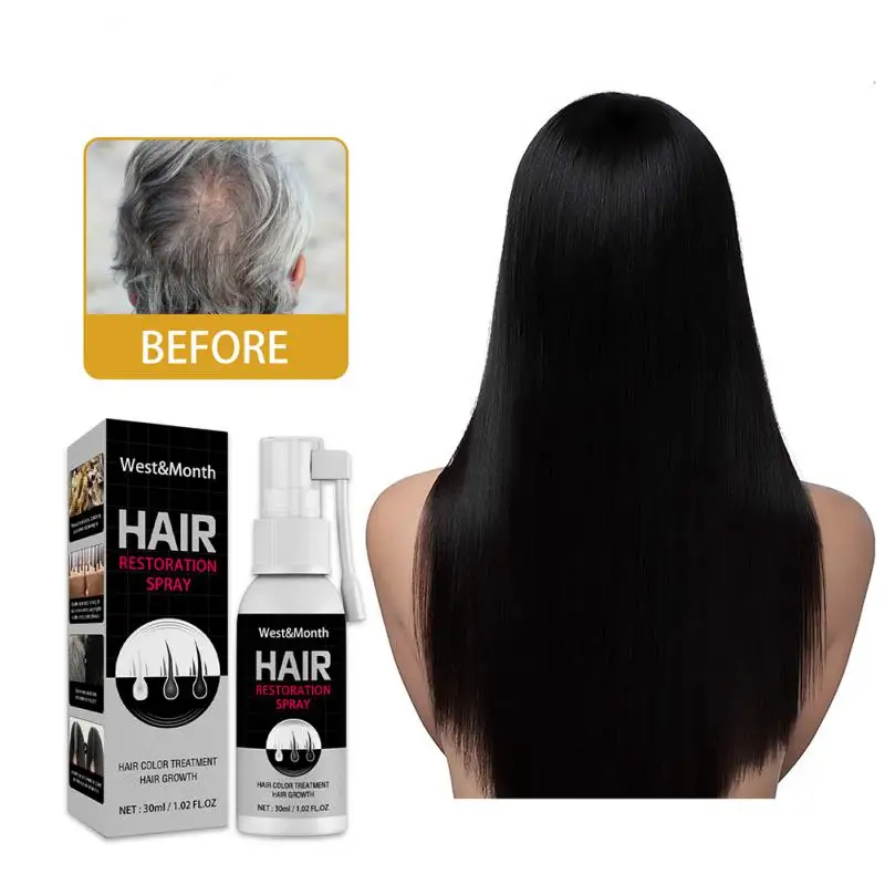 30ml Black Hair Liquid Spray Plant Extract Nourishes Repairs The Scalp Anti Hair Loss Hair Growth Spray Reduce White Hair TSLM2
30ml Black Hair Liquid Spray Plant Extract Nourishes Repairs The Scalp Anti Hair Loss Hair Growth Spray Reduce White Hair TSLM2