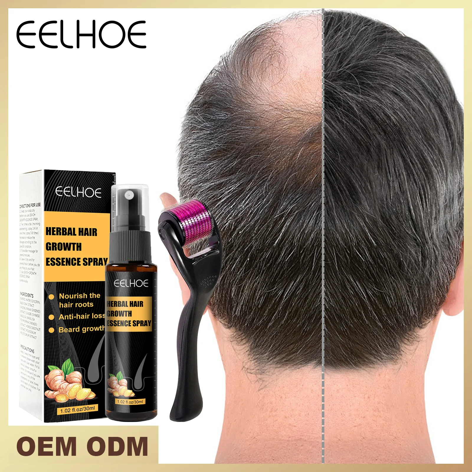 Hair fall prevention nourishing care solution scalp dense hair to improve hair breakage herbal anti-falling roller essence
Hair fall prevention nourishing care solution scalp dense hair to improve hair breakage herbal anti-falling roller essence