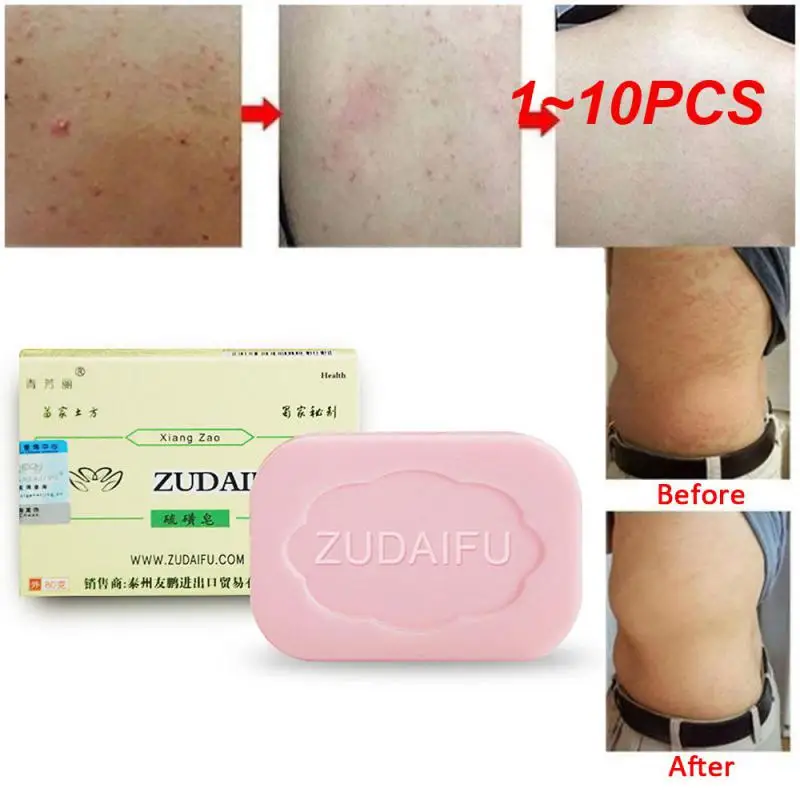 

1 ~ 10 шт. Zudaifu серное мыло очищающее средство контроль жирности Отбеливание лица серное мыло очищающее средство для кожи мыло ручной работы