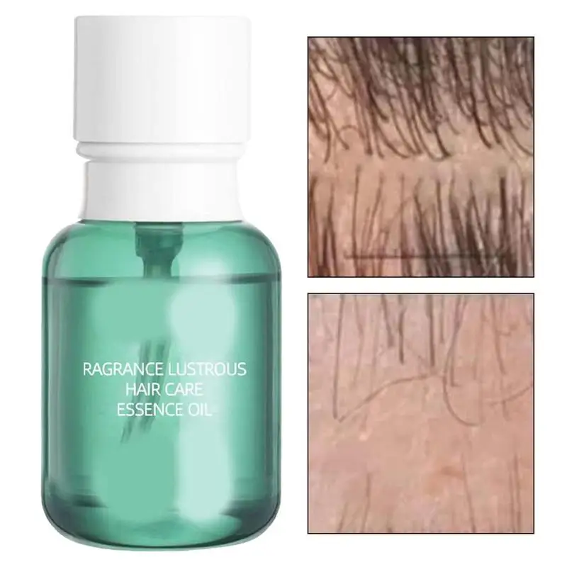 Hair Growth Essence 2.11oz Hair Growth Boost Oil Accelerates Natural Hair Growing Head Scalp Spray For Women's Hair Loss Thicken 
Hair Growth Essence 2.11oz Hair Growth Boost Oil Accelerates Natural Hair Growing Head Scalp Spray For Women's Hair Loss Thicken