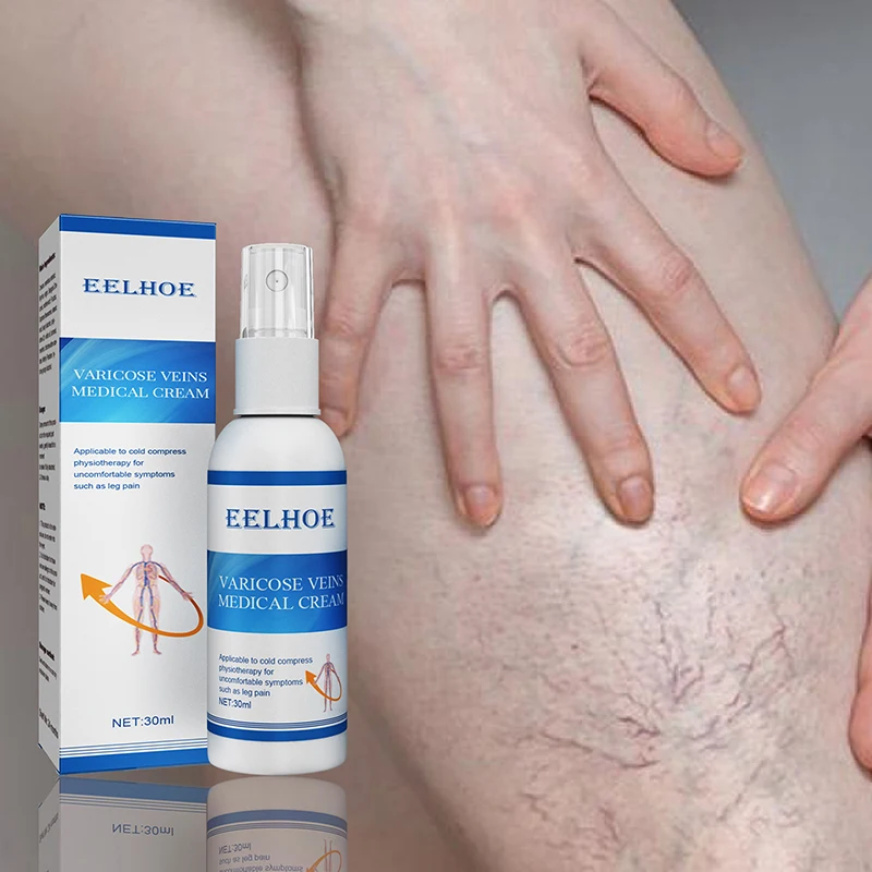 30ML Varicose Vein Soothing Spray Portable Veins Spray Professional Earthworm Leg Treatment Supplies Vein Soothing Spray EIG88
30ML Varicose Vein Soothing Spray Portable Veins Spray Professional Earthworm Leg Treatment Supplies Vein Soothing Spray EIG88