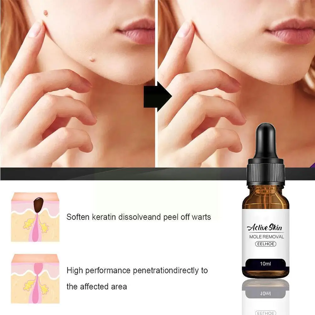 Body Care Solution Mole And Wart Essence Skin Face Armpit Meat Repair Cleaning Neck Care Removal F2l1
Body Care Solution Mole And Wart Essence Skin Face Armpit Meat Repair Cleaning Neck Care Removal F2l1