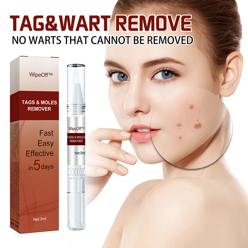 Keratosum Liquid Skin Label Removal Liquid Corns Keratosum Cream For Plantar Verruca Skin Care Products Wart Remover
Keratosum Liquid Skin Label Removal Liquid Corns Keratosum Cream For Plantar Verruca Skin Care Products Wart Remover