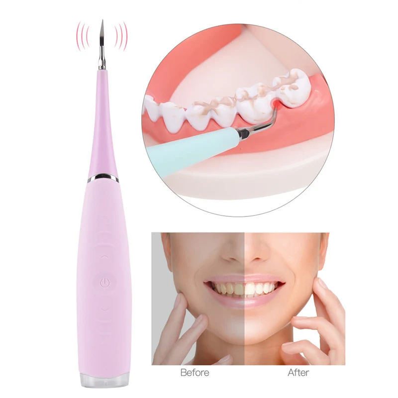 

Oral Irrigator Ultrasonic Sonic Dental Scaler Tooth Calculus Remover Cleaner Tooth Stains Tartar Tool Whiten Teeth Tartar Remove
