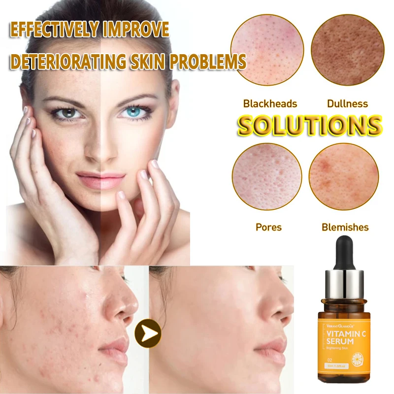 Vitamin C Facial Essential Oil Brightens Skin Tone Repair Acne Marks Fade Spots Nourish Anti-aging Essence
Vitamin C Facial Essential Oil Brightens Skin Tone Repair Acne Marks Fade Spots Nourish Anti-aging Essence