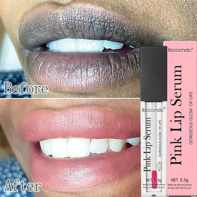 Lips Pink Fresh Lightening Bleaching Cream Remove Dark Smoke Treatment Lip Balm Whiten Moisturizer Nourish Serum Beauty Health
Lips Pink Fresh Lightening Bleaching Cream Remove Dark Smoke Treatment Lip Balm Whiten Moisturizer Nourish Serum Beauty Health