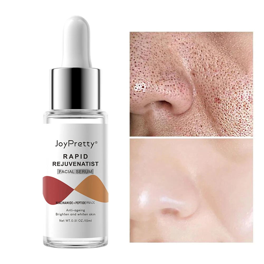 Face Serum Anti-Aging Fade Dark Spots Remove Fine Lines Skin Whitening Firming Moisturizing Serum For All Skins 15ml 2022 New
Face Serum Anti-Aging Fade Dark Spots Remove Fine Lines Skin Whitening Firming Moisturizing Serum For All Skins 15ml 2022 New