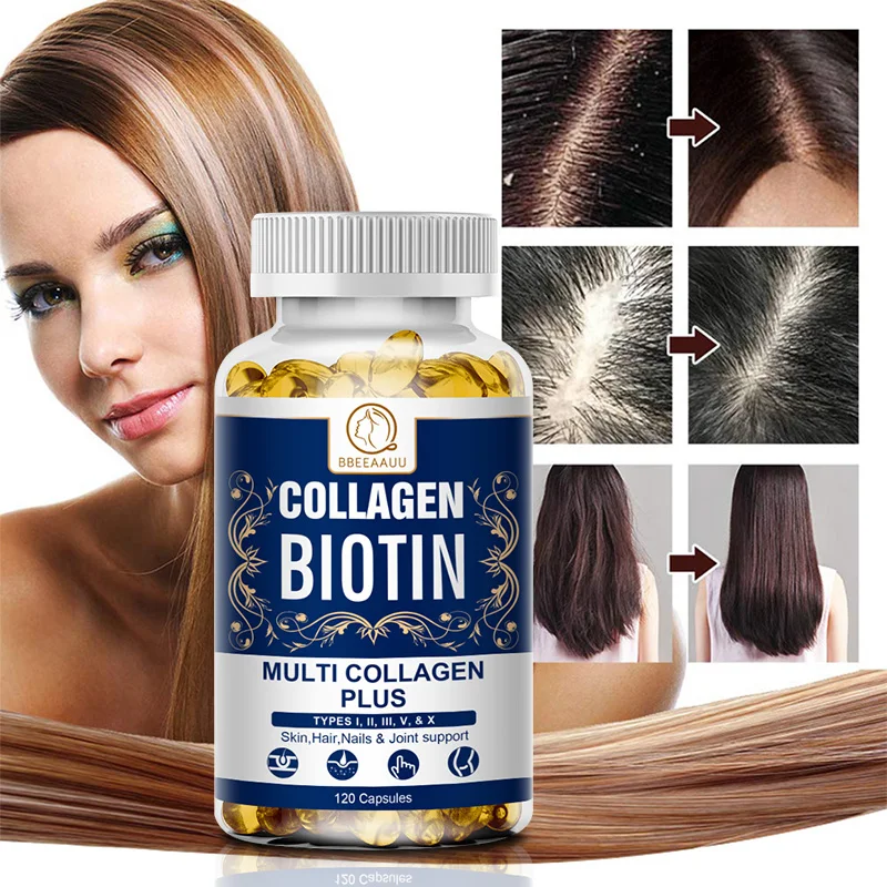 BBEEAAUU Collagen Biotin for Hair and Nails Growth Whitening Anti-wrinkle Anti Aging Increase Hair Volume Hair Care Skincare
BBEEAAUU Collagen Biotin for Hair and Nails Growth Whitening Anti-wrinkle Anti Aging Increase Hair Volume Hair Care Skincare
