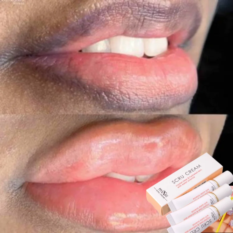 Magic Lip Lighten Scrub Dark Black Lip Removal Exfoliation Pigmentation Fade Dull Pink Lip Balm Brighten Anti-Crack Moisturizing
Magic Lip Lighten Scrub Dark Black Lip Removal Exfoliation Pigmentation Fade Dull Pink Lip Balm Brighten Anti-Crack Moisturizing