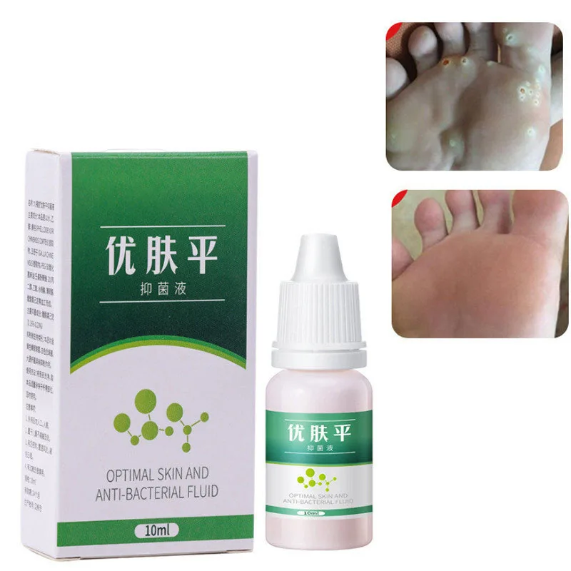 Wart Remover Of Warts Liquid From Skin Tags Removing Against Moles Anti Verruca Antibacterial Skin Care Herbal Medicine Liquid
Wart Remover Of Warts Liquid From Skin Tags Removing Against Moles Anti Verruca Antibacterial Skin Care Herbal Medicine Liquid