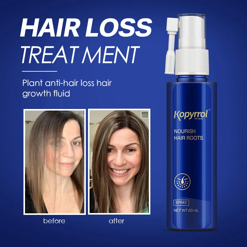 60ML Hair Root Nourishing Liquid Hair Fast Growth Spray Effective Hair Loss Treatment Hair Thicker Fuller Herbal Essential Serum
60ML Hair Root Nourishing Liquid Hair Fast Growth Spray Effective Hair Loss Treatment Hair Thicker Fuller Herbal Essential Serum
