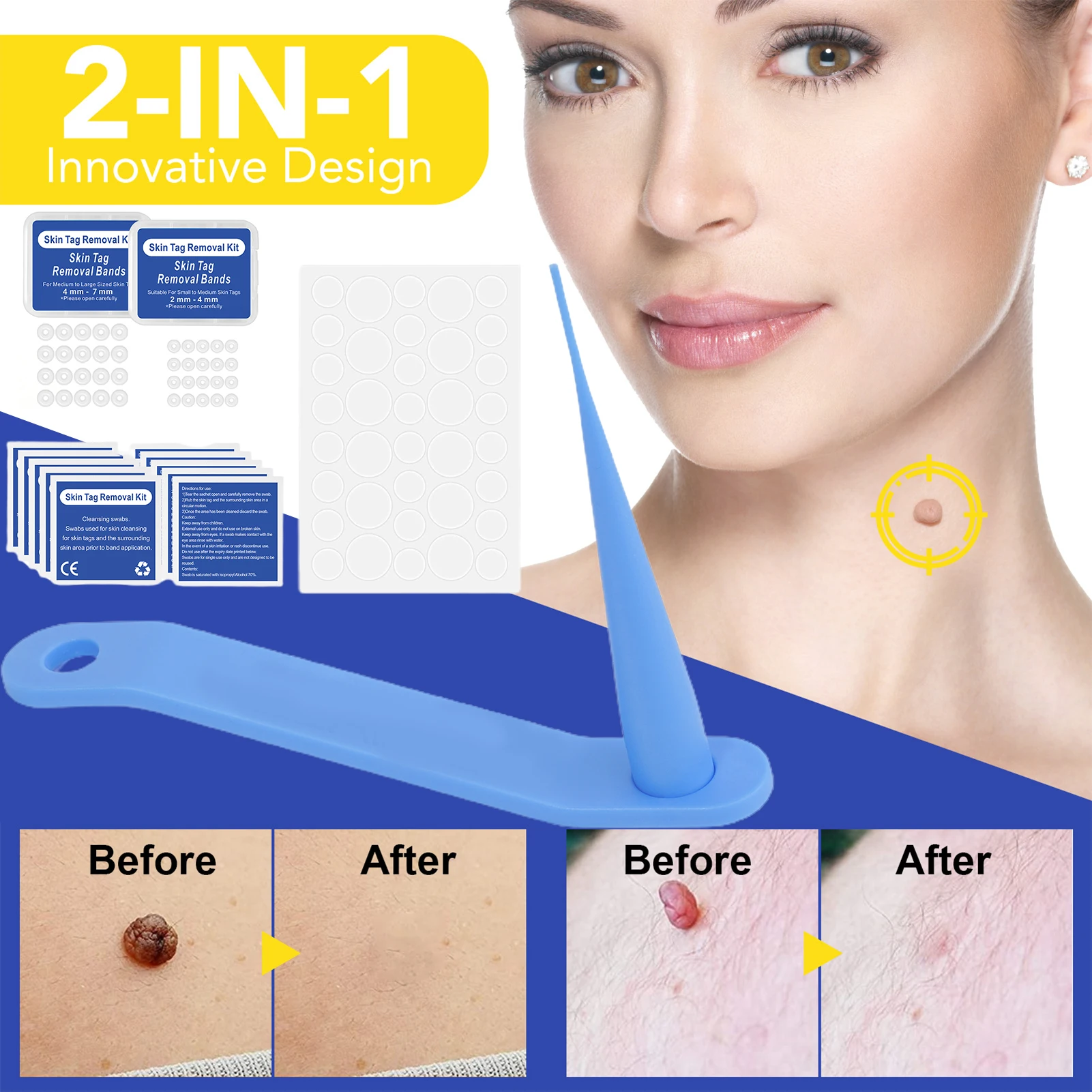 Skin Tag Removal Tools Kit Stem Warts & Mole Removal Set For Face Neck And Body Safe & Painless Wart Remover Beauty Care Tools 
Skin Tag Removal Tools Kit Stem Warts & Mole Removal Set For Face Neck And Body Safe & Painless Wart Remover Beauty Care Tools