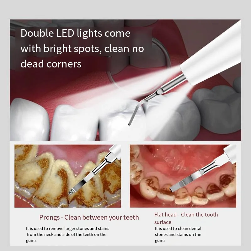 New Ultrasonic Electric Household Cleaning Tooth Cleaner Yellow Teeth Smoke Stain Tooth Stone Remover Punch Artifact 
New Ultrasonic Electric Household Cleaning Tooth Cleaner Yellow Teeth Smoke Stain Tooth Stone Remover Punch Artifact