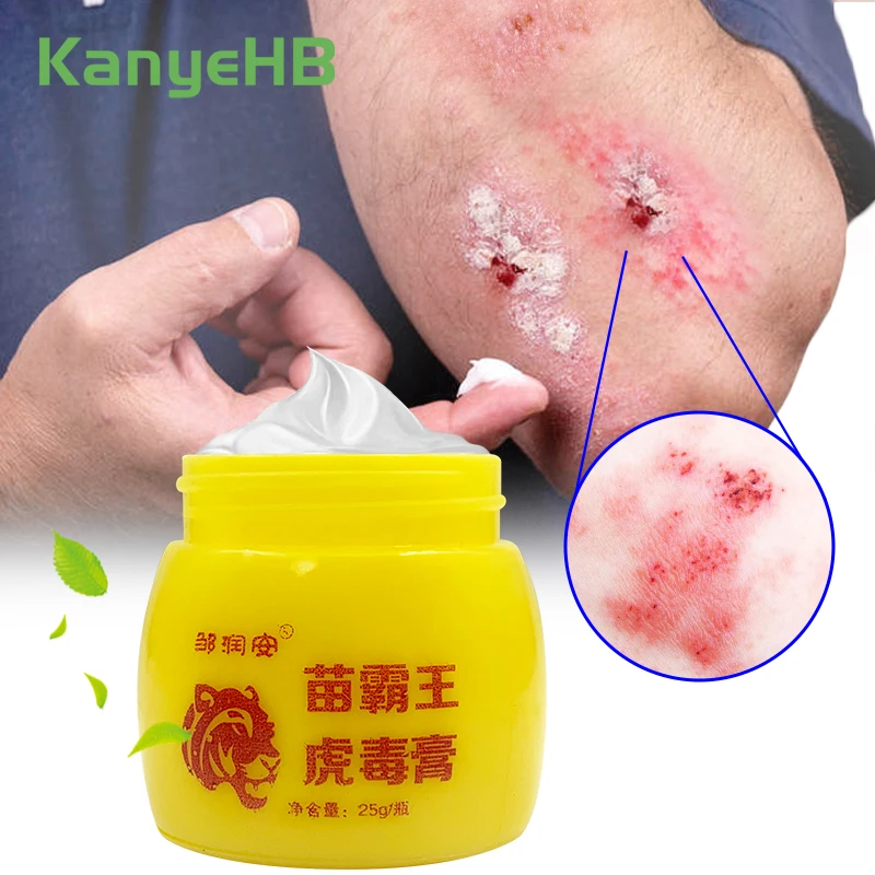 1Pcs Psoriasis Skin Care Ointment Treatment Seborrheic Dermatitis Eczema Head Acne Pruritus Relief Herbal Medical Cream S105
1Pcs Psoriasis Skin Care Ointment Treatment Seborrheic Dermatitis Eczema Head Acne Pruritus Relief Herbal Medical Cream S105