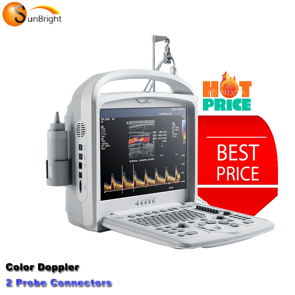 Portable Used Laptop 2D Color Doppler Pregnancy medical ultrasound instruments Price For Sale
Portable Used Laptop 2D Color Doppler Pregnancy medical ultrasound instruments Price For Sale