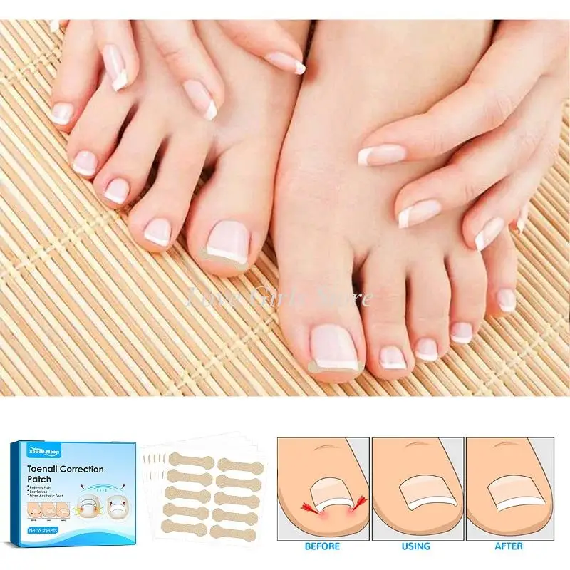 60pcs Nail Correction Stickers Ingrown Toenail Corrector Patches Waterproof Paronychia Treatment Recover Corrector Pedicure Tool
60pcs Nail Correction Stickers Ingrown Toenail Corrector Patches Waterproof Paronychia Treatment Recover Corrector Pedicure Tool