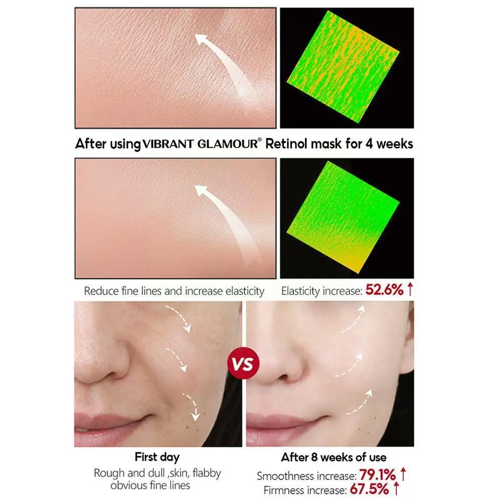 Green Tea Aloe Vera Clearing Mud Cream Moisturizing Acne Skin Boxed Smear Care Products Korean Oil-control Relief R0y4
Green Tea Aloe Vera Clearing Mud Cream Moisturizing Acne Skin Boxed Smear Care Products Korean Oil-control Relief R0y4