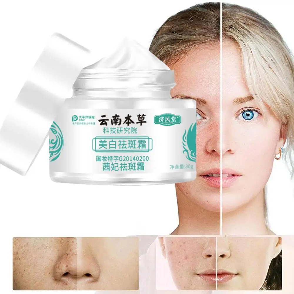 30g Whitening Freckle Cream Lightens Freckles Melasma Tone Skin Firming Brightening Skin Products Care Anti-aging Skin Girl Y9V6
30g Whitening Freckle Cream Lightens Freckles Melasma Tone Skin Firming Brightening Skin Products Care Anti-aging Skin Girl Y9V6