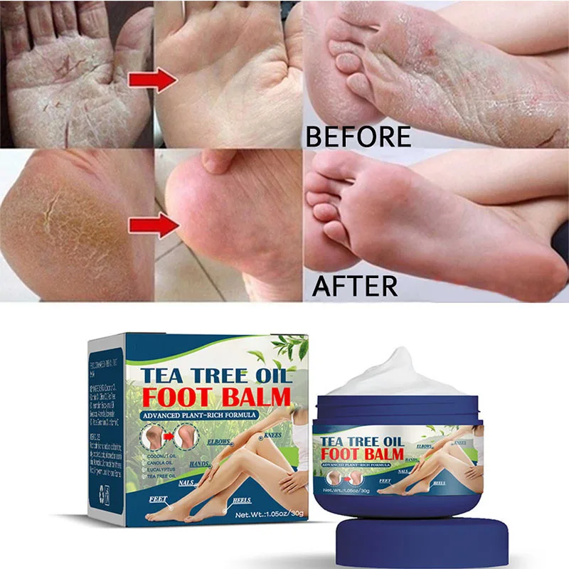 Foot Peeling Anti-Drying Crack Foot Cream Heel Cracked Repair Cream Removal Dead Skin Moisturizing Whitening Hand Feet Care 30g
Foot Peeling Anti-Drying Crack Foot Cream Heel Cracked Repair Cream Removal Dead Skin Moisturizing Whitening Hand Feet Care 30g
