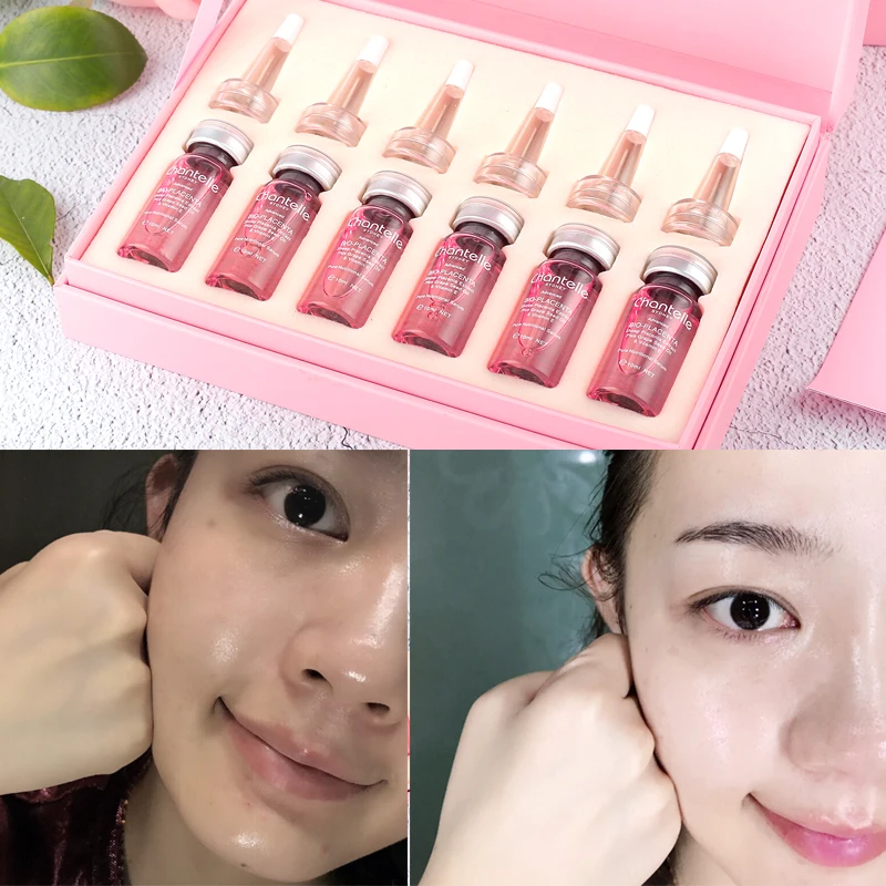 Original Australia Chantelle Pink BioPlacenta Serum 10ml Advanced Sheep Placenta for Age Spots Brighten Firming Skin Radiance
Original Australia Chantelle Pink BioPlacenta Serum 10ml Advanced Sheep Placenta for Age Spots Brighten Firming Skin Radiance