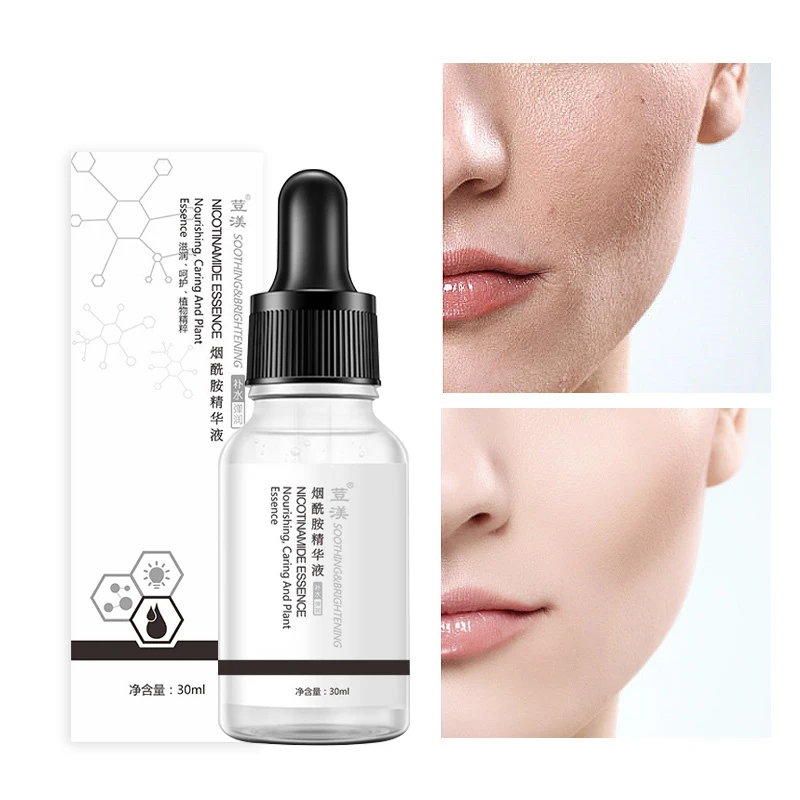 Niacinamide Anti-Aging Serum Repair Skin Whitening Lifting Firming Licorice Essence Shrink Pore Skin Moisturizing Essential Oil
Niacinamide Anti-Aging Serum Repair Skin Whitening Lifting Firming Licorice Essence Shrink Pore Skin Moisturizing Essential Oil
