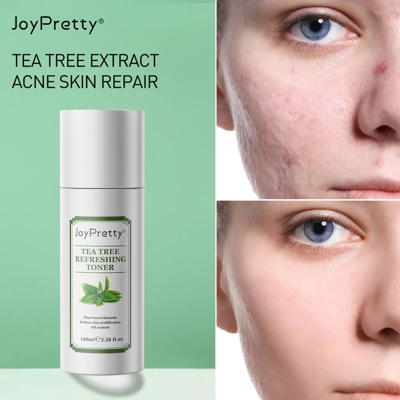 Anti Aging Skin Care Facial Toner Skin Moisturizing for All Skin Types 100ml Brightening Recondition And Purify Skin
Anti Aging Skin Care Facial Toner Skin Moisturizing for All Skin Types 100ml Brightening Recondition And Purify Skin