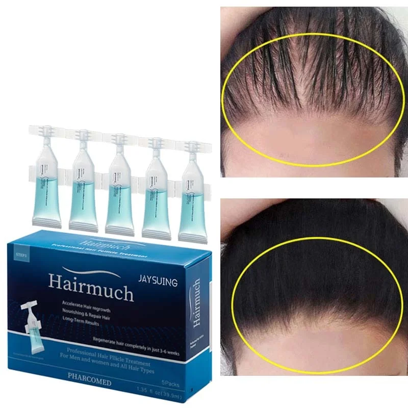 Hair Growth Serum Anti-Hair Loss Prevention Baldness Fast Hair Growing Products Treatment Dry Damage Nourish Repair Scalp Care
Hair Growth Serum Anti-Hair Loss Prevention Baldness Fast Hair Growing Products Treatment Dry Damage Nourish Repair Scalp Care