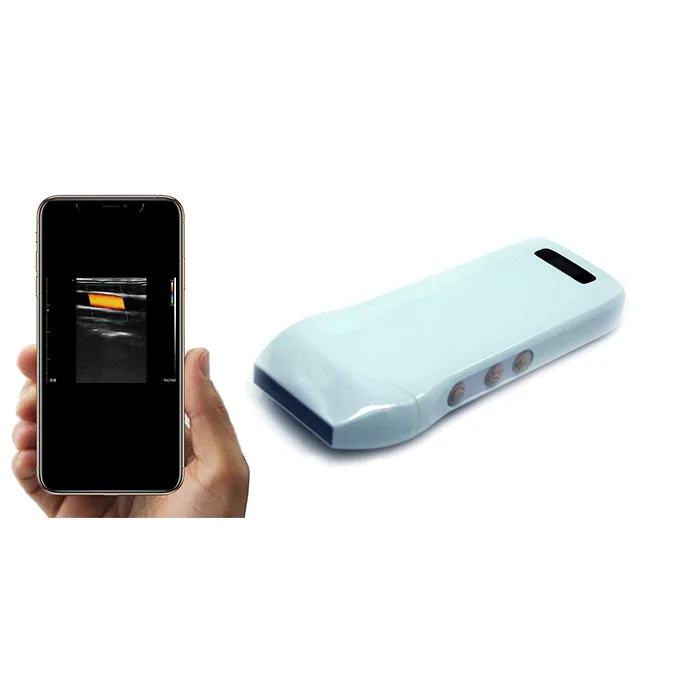 5G wifi Channel Konted 192 Elements Wireless Ultrasound iPad iPhone Ultrasound Probe / Scanner
5G wifi Channel Konted 192 Elements Wireless Ultrasound iPad iPhone Ultrasound Probe / Scanner