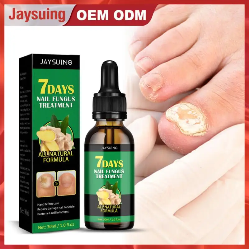 1~20PCS Nail Fungal Oil Foot Toe Nail Fungus Removal Serum 7 Days Repair Onychomycosi Anti Gel Care
1~20PCS Nail Fungal Oil Foot Toe Nail Fungus Removal Serum 7 Days Repair Onychomycosi Anti Gel Care