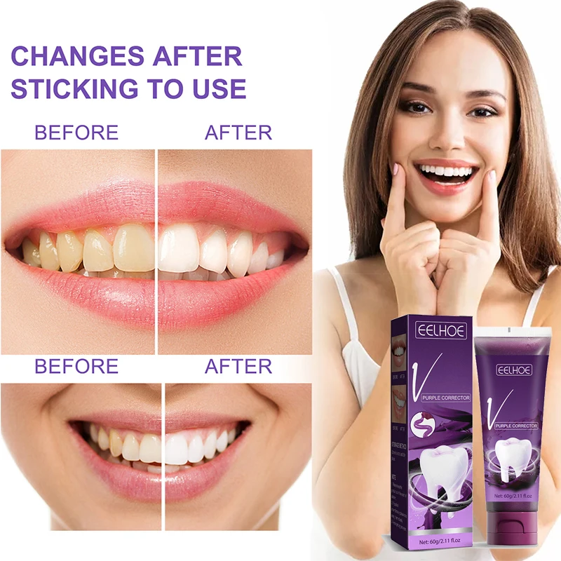 Whitening Toothpaste Removes Stains Teeth Oral Hygiene Mousse Colour Corrector Breathing Freshener Toothpaste
Whitening Toothpaste Removes Stains Teeth Oral Hygiene Mousse Colour Corrector Breathing Freshener Toothpaste