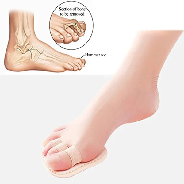 1 Pair Toe Separators Anti-skid Overlapping Correctors Spreader for Hammer Toes Bunion Hallux Valgus
1 Pair Toe Separators Anti-skid Overlapping Correctors Spreader for Hammer Toes Bunion Hallux Valgus