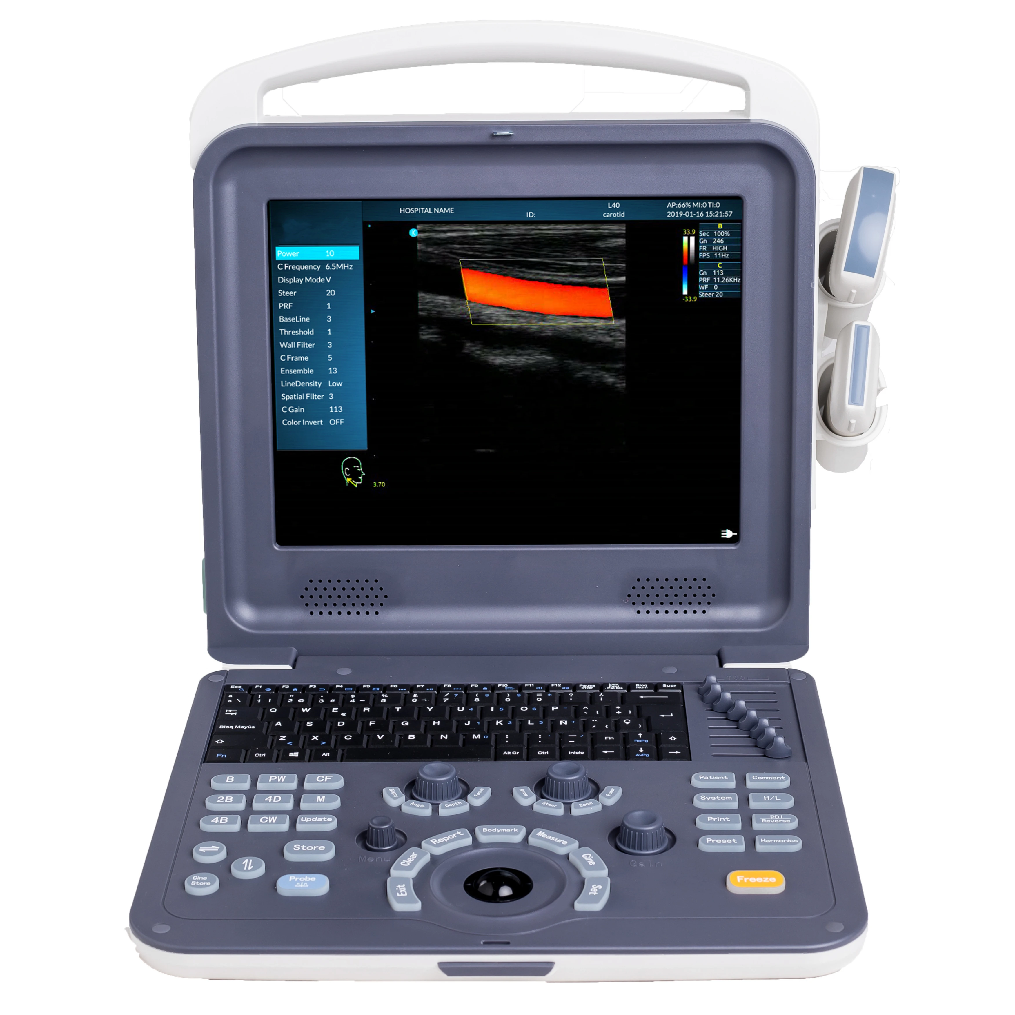 Hot selling 2D Medical Ultrasound Instruments Portable Color Doppler 
Hot selling 2D Medical Ultrasound Instruments Portable Color Doppler