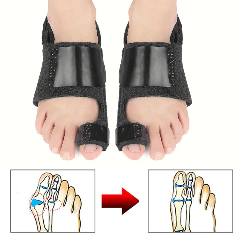 1Pair Hallux Valgus Stretcher Big Toes Bunion Splint Straightener Corrector Foot Care Pedicure Separator Toes Corrector
1Pair Hallux Valgus Stretcher Big Toes Bunion Splint Straightener Corrector Foot Care Pedicure Separator Toes Corrector