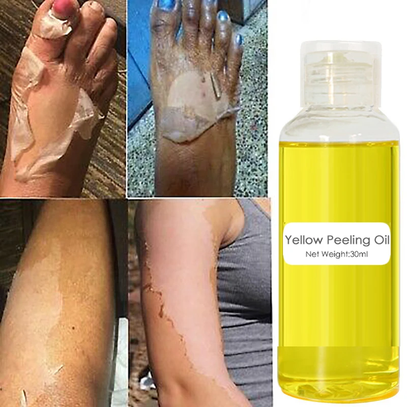 30/50ml Thai Yellow Peeling Oil Bleaching Dark Skin Retinol with Peptide Spots Blackheads Blemishes Bad Skin Spot Whitening Skin
30/50ml Thai Yellow Peeling Oil Bleaching Dark Skin Retinol with Peptide Spots Blackheads Blemishes Bad Skin Spot Whitening Skin