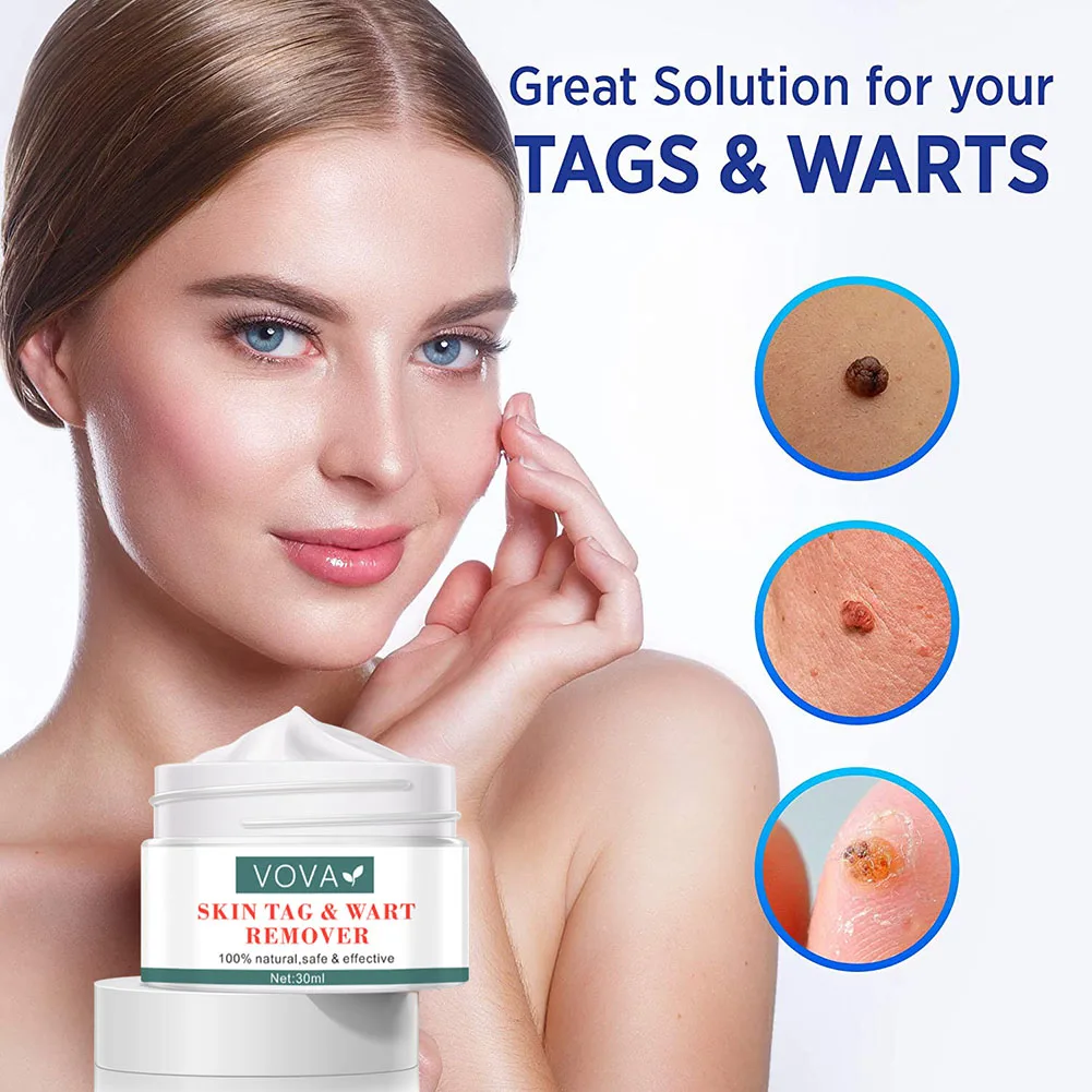 Skin Tag & Wart Removal Cream Fast Acting Natural Ingredients Wart Repair Treatment Cream for Face Body
Skin Tag & Wart Removal Cream Fast Acting Natural Ingredients Wart Repair Treatment Cream for Face Body