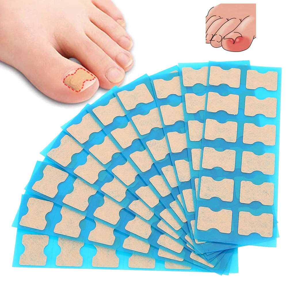 Ingrown Toenail Correction Patch Foot Care Pedicure Sticker Toenail Treatment Beauty Tool Nail Repairer Orthosis Relieve Pain
Ingrown Toenail Correction Patch Foot Care Pedicure Sticker Toenail Treatment Beauty Tool Nail Repairer Orthosis Relieve Pain