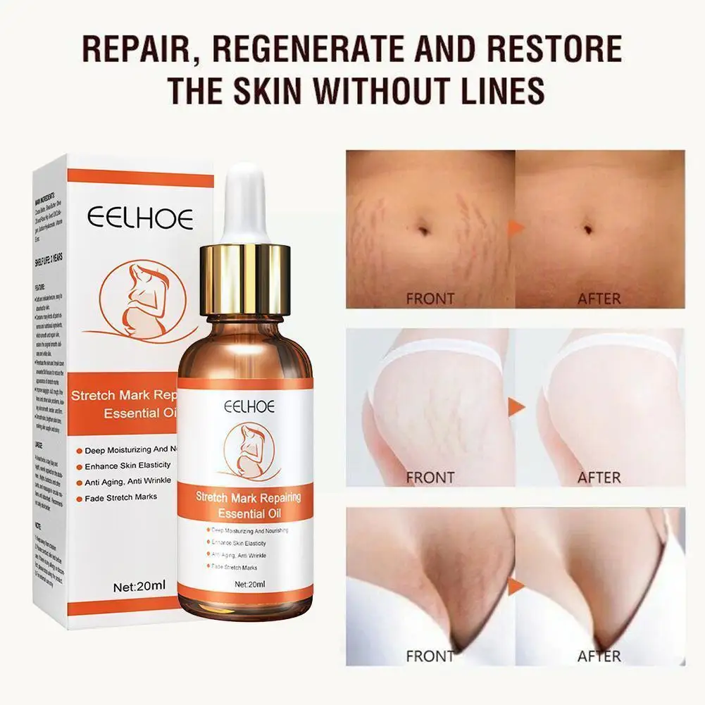 20ml Stretch Marks Removal Oil Pregnant Women Pregnancy New Care Remover Maternity Old Body Cream Scar Skin Firming Treatme P3y3
20ml Stretch Marks Removal Oil Pregnant Women Pregnancy New Care Remover Maternity Old Body Cream Scar Skin Firming Treatme P3y3
