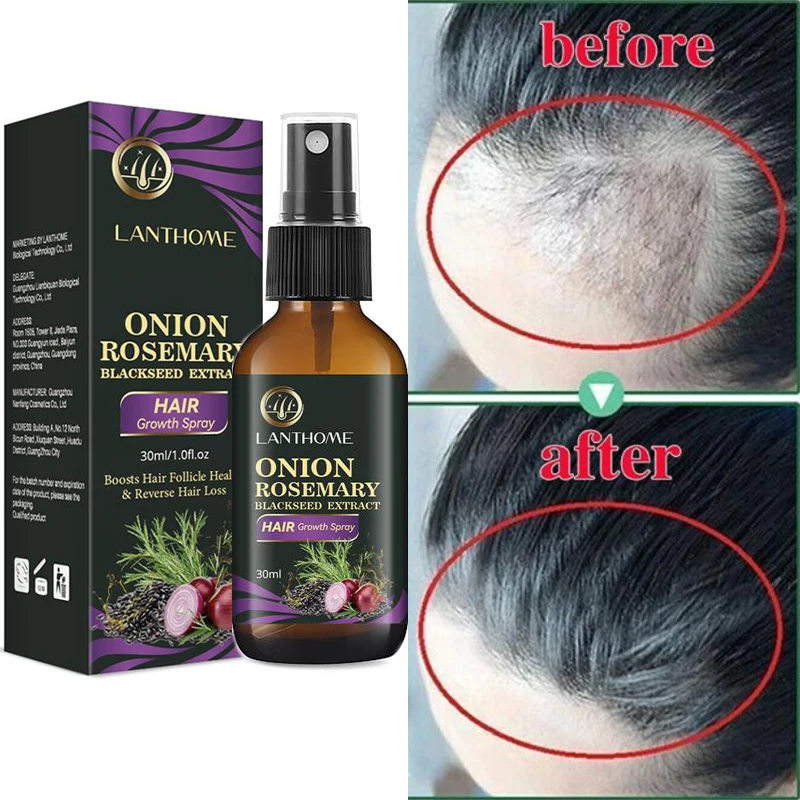 Sdotter Fast Hair Growth Spray Products Effective Anti Hair Loss Serum Regrowth Repair Damaged Hair Roots Beauty Health Care Men
Sdotter Fast Hair Growth Spray Products Effective Anti Hair Loss Serum Regrowth Repair Damaged Hair Roots Beauty Health Care Men
