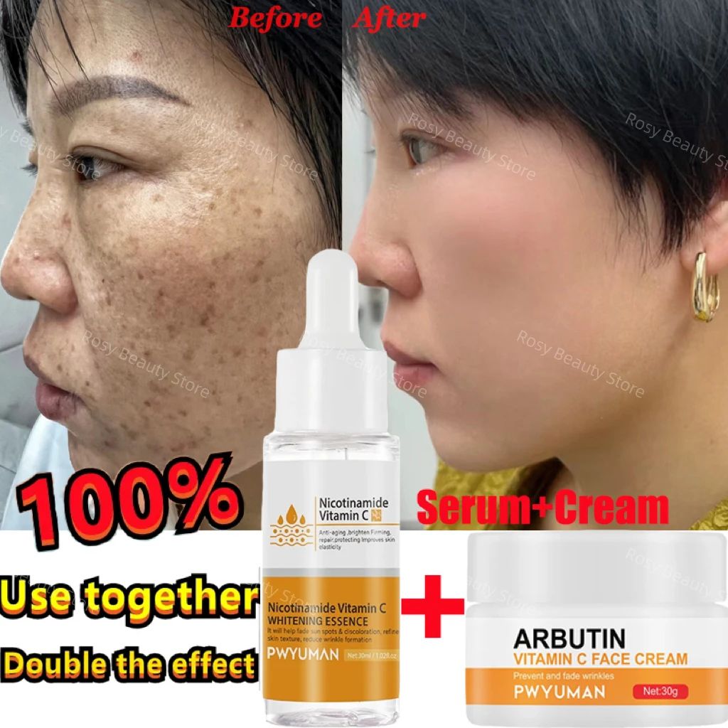 Niacinamide Whitening Freckles Serum Cream Remove Dark Spots Melasma Vitamin C Lighten Melanin Acne Scars Anti-aging Skin Care
Niacinamide Whitening Freckles Serum Cream Remove Dark Spots Melasma Vitamin C Lighten Melanin Acne Scars Anti-aging Skin Care