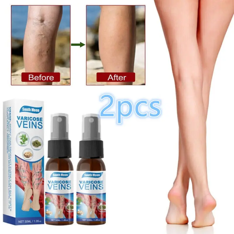 2PCS/lot Varicose Veins Spray Medicine Spider Veins Treatment Relief Vasculitis Phlebitis Spider Pain Relief Medical Plaster 30m
2PCS/lot Varicose Veins Spray Medicine Spider Veins Treatment Relief Vasculitis Phlebitis Spider Pain Relief Medical Plaster 30m