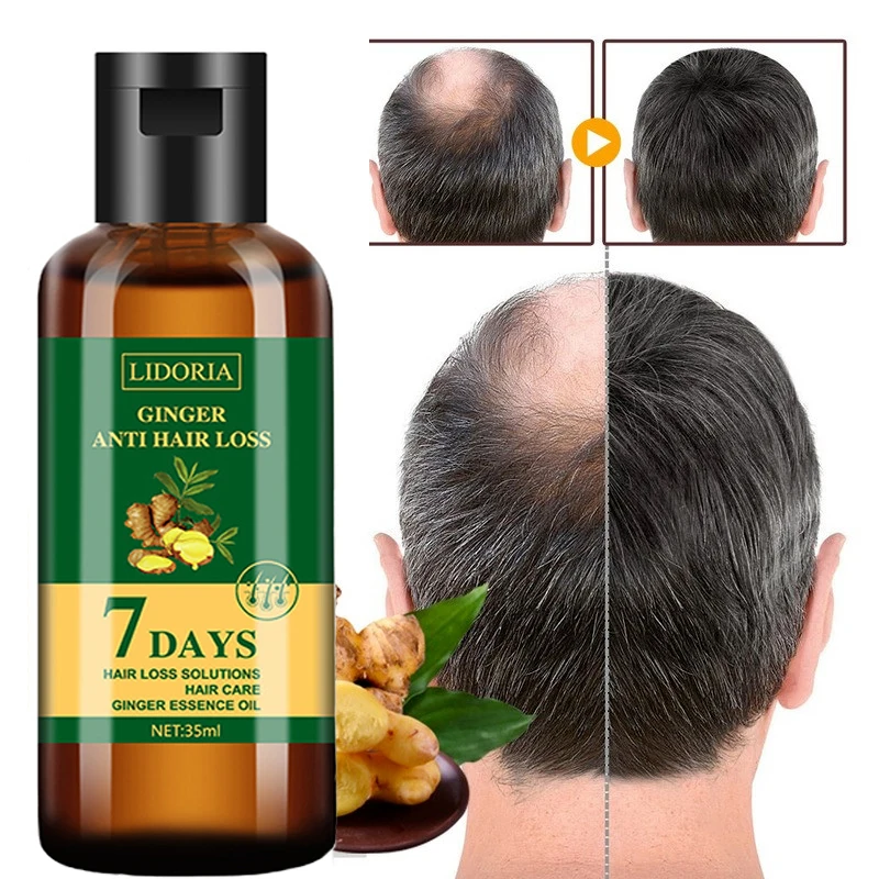 Hair Growth Products Ginger Fast Growing Hair Essential Oil Beauty Hair Care Prevent Hair Loss Oil Scalp Treatment For Men Women
Hair Growth Products Ginger Fast Growing Hair Essential Oil Beauty Hair Care Prevent Hair Loss Oil Scalp Treatment For Men Women