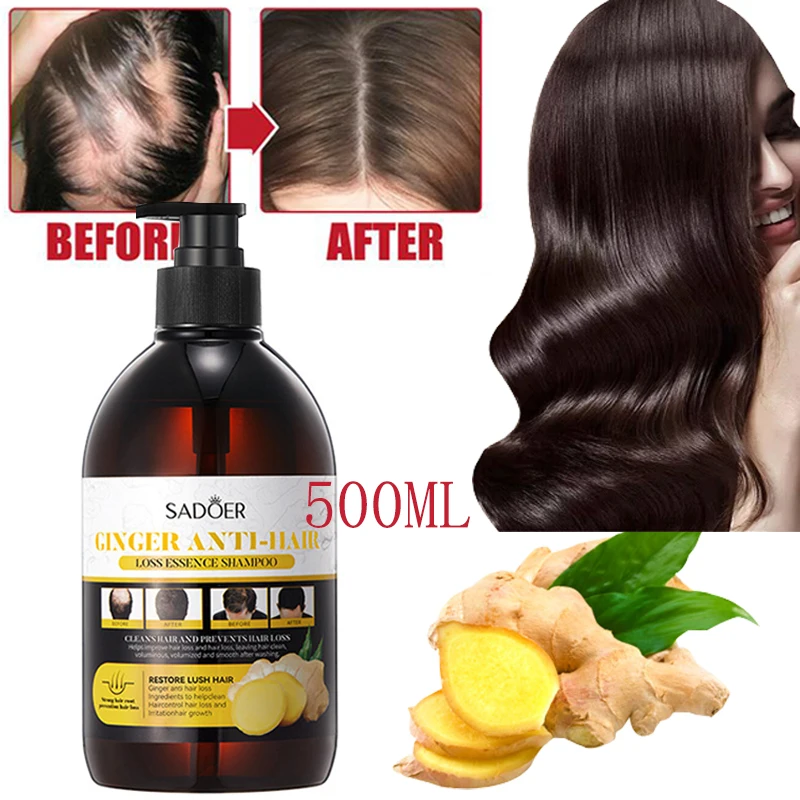 Шампунь для роста волос Ginger, товары для быстрого роста волос, утолщенный Восстанавливающий эффект от поврежденных волос, от перхоти, питательный уход за кожей головы, Стайлинг
Шампунь для роста волос Ginger, товары для быстрого роста волос, утолщенный Восстанавливающий эффект от поврежденных волос, от перхоти, питательный уход за кожей головы, Стайлинг